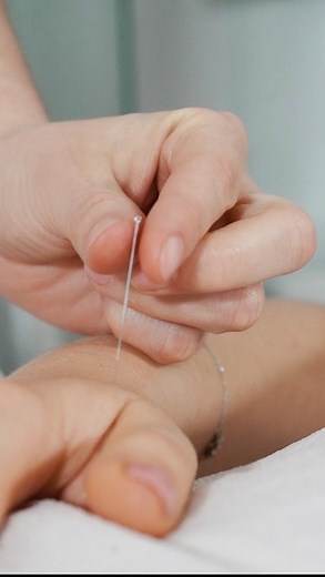 Give acupuncture a try… | Advanced Holistic Center