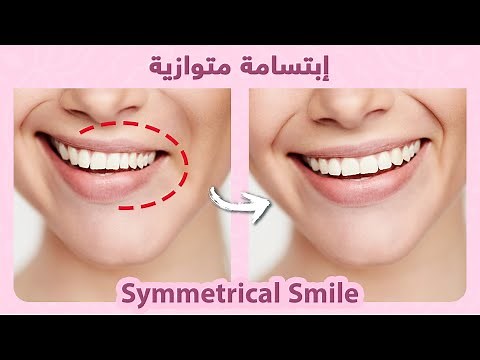 How to naturally fix smile asymmetry