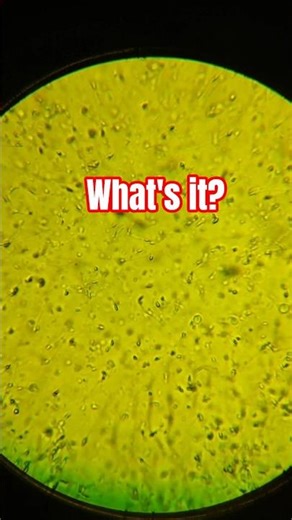 Sperm under a microscope #microscope #exploration #bacteria