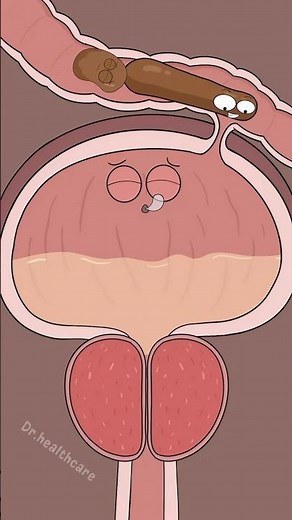 How Can Poop Get Into Your Bladder?