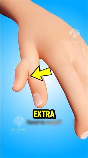 If You Ever See an Extra Finger on Your Hand, Watch This Fast