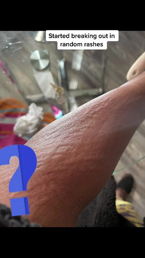 Understanding Allergies and Skin Reactions: Causes and Solutions