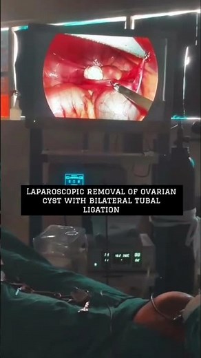 Laparoscopic ovarian cyst removal || minimal invasive surgery || Early recovery