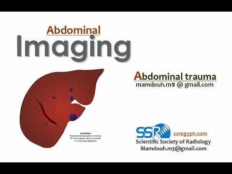 5- Imaging of abdominal trauma Prof Mamdouh Mahfouz