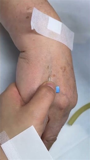 How to Give IV Injection Safely | Intravenous Nursing Skills | doctor IV and Intramuscular IM*64