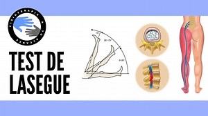 9K views · 133 reactions | TEST DE LASEGUE, COMO SABER SI LA CIATICA...