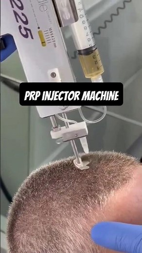 PRP Hair Treatment | prp hair loss treatment before and after | Hair Loss Treatment