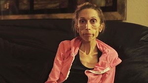 Una mujer anoréxica pide ayuda en internet para salvar su vida