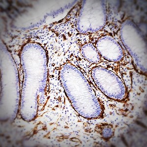 Immunohistochemical staining is used by #PMIScience scientists to...