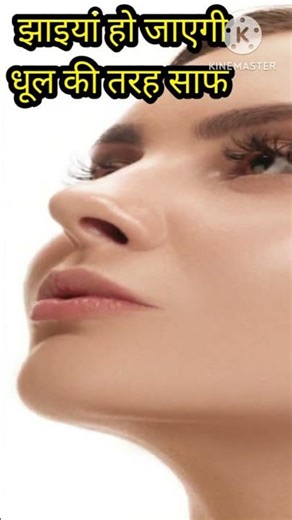 “जिद्दी झाइयां खत्म! ये क्रीम कर देगी Bye Bye pigmentation cream uses in hindi