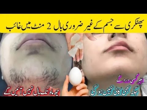 Without threading👉🏻😱I'm surprise how aunty's beard &moustache removed|facial hair removal at home