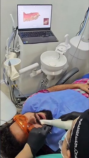 Qué es el Escaner intraoral, Smile makeover Cartagena Clinica Dental