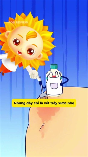 Vết trầy xước nhỏ, xử lý thế nào cho đúng? #shorts #viralvideo