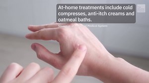 Skin Problems From Laundry Detergent? Here's What To Do