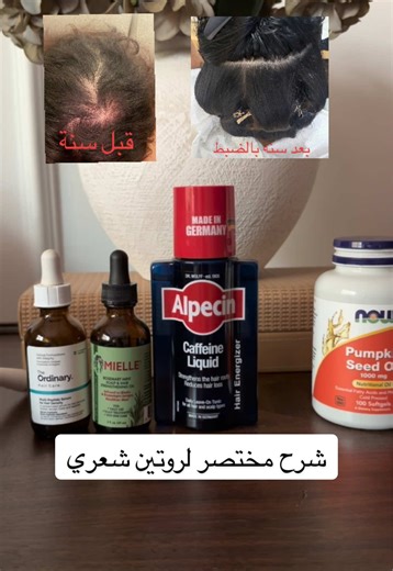 انا ما أصدق كل شي اشوفه ويوصون عليه الا اذا بحثت وقريت علمياً لذلك هذا مختصر ليش الروتين فعال.. روتيني كل فترة احسن عليه الحين صار عادي ماحطه كل يوم وباقي محافظة على نتايجه.. ليش؟ لاني مهتمه بالفايتمنز للحد المثالي وهي الاساس مهتمه بنظافه فروتي وحاجتي للمحفزات قلت وماعندي تساقط الحمدلله .. @K18 Hair @Kérastase Institute @The Ordinary Store UK @L’Oréal Paris Arabia @Breo US @iHerb #fyp #beauty #تساقط_الشعر #haircare