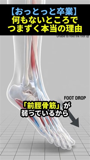 [Stop Tripping] The Reason You Stumble on Flat Ground! A Physical Therapist's Go-To Exercises to ...
