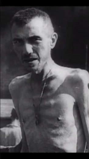 Liberation of a German Camp — Prisoners Receive Treatment, 1945