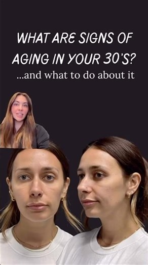 Why do my eyes look so tired in my 30s?