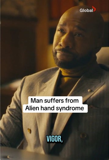 Alien Hand Syndrome: A Rare Neurological Disorder