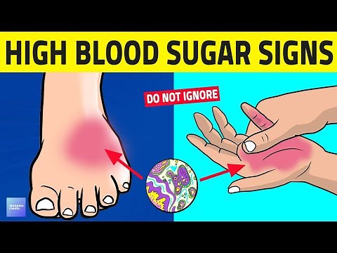 7 Alarming Signs Your Blood Sugar Is Too High