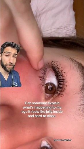 “Your Immune System Has Found Your Eyes” #wait