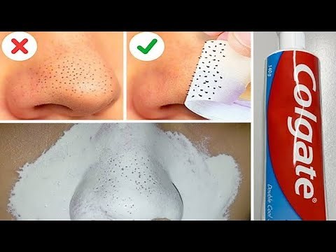How To Remove BLACKHEADS at Home | In Just 5 Mints Best Way to Remove BLACKHEADS With Toothpaste