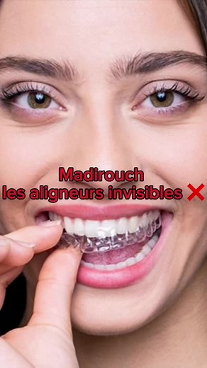 Invisalign et traitement dentaire en Algérie