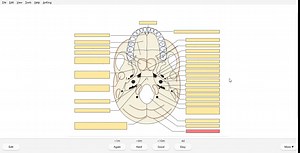 Image Occlusion Enhanced One by One Incremental