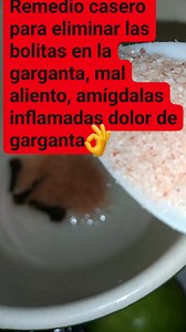 Remedio casero para eliminar las bolitas en la garganta, mal aliento, amígdalas inflamadas, dolor de garganta #reels #reelsvideoシ #reelsfb #remedioscaseros | Vida Sana y Salva