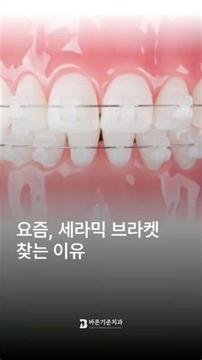 요즘, 세라믹 브라켓 찾는 이유 | #치아교정 #건강정보