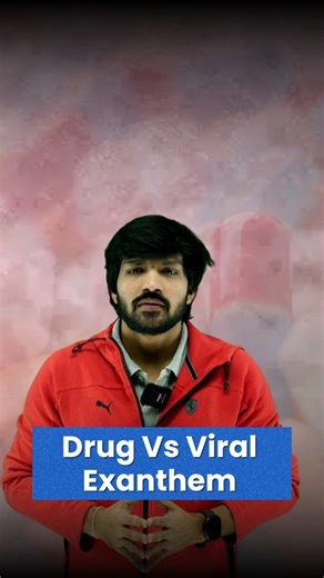 DrSubodh Chaturvedi | Drug Vs Viral Exanthem Differentiating Drug Exanthem vs. Viral Exanthem! 🕵️‍♂️ rashes A patient comes in with an acute maculopapular... | Instagram