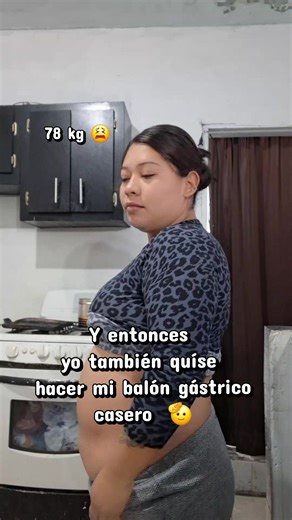 Mi balón gástrico casero: Día 1 del proceso