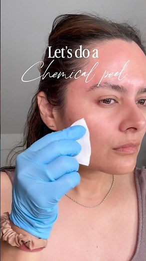 Chemical Peel at home! Ft #platinumskincare #skincare #chemicalpeel #diychemicalpeel #mandelicacid