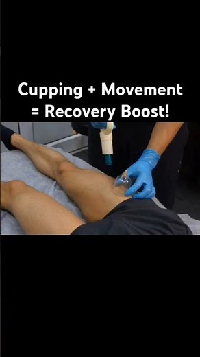 "Leg Cupping Therapy + Movement | Pain Relief & Recovery"