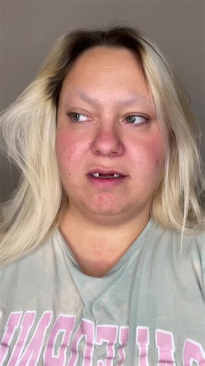 The Power Of Makeup 💄 #noteeth #viral #trending #dentures #veneers #clipinveneers #cliponveneers #contourtutorial #nosecontour #makeup #makeupofinstagram #makeuplook #makeupaddict #makeyupworld #makeupdolls #makeupwedding #makeuptutorial #makeupaccounts #makeuppowder #smallbeauytyinflueuncer #weightlossjourney | Lashes And Losing