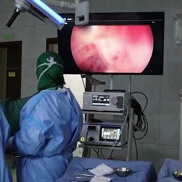 Hysteroscopy
