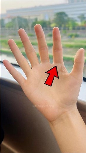 The Truth About Extra Fingers