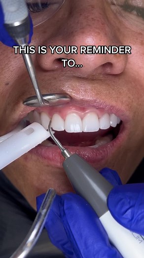 Dental Cleaning and Plaque Removal: Tips and Procedures