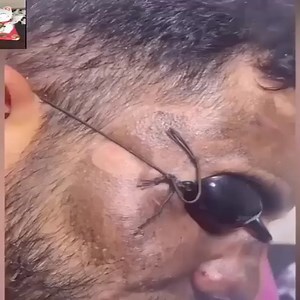 4.8M views · 6.5K reactions | Amazing laser beauty technology | RENOJ Drumbeaters Arts & Craft | Facebook