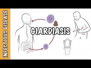 Giardiasis - Giardia Lamblia (Giardia intestinalis, Giardia duodenalis) infection • Video • MEDtube.net