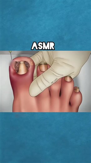 #ASMR#ASMRtreatment#RelaxingASMR#Satisfying#Satisfyingvideo