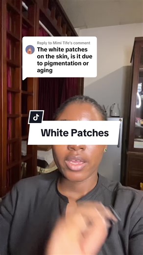 Understanding White Patches on Skin | Causes and Remedies