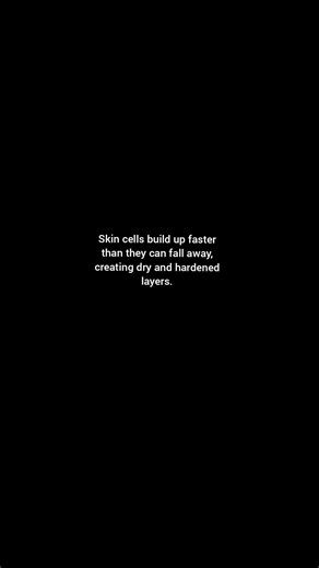 #Ichthyosis #RareSkinCondition #SkinDisorder #GeneticCondition #RareDisease #Dermatology