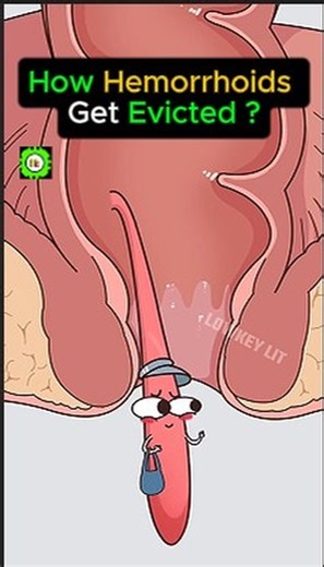 Human | Wellness on Instagram: "How Hemorrhoids Get Evicted? #funny #cartoon #shorts #animation 👉 Follow @entrepreneureshuman for more funny and healthy cartoons."