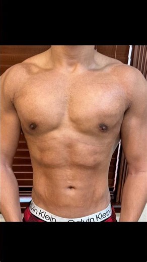 Pre-Op vs. 8 Weeks Later - WOW! #bodytransformation #male #plasticsurgery #results #beforeandafter