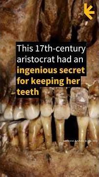 This 17th-Century Aristocrat Had an Ingenious Secret For Keeping Her Teeth