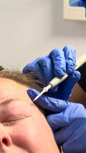 Skin Tag Removal: What to Expect During Treatment