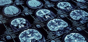 Patents 101 | Office of Technology Management | University of Illinois Chicago