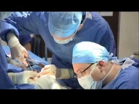 1st / 2nd stages: Ear reconstruction in microtia - Dr Greg O'Toole / Dr Walid Sabbagh