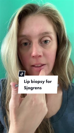 Replying to @Sabrinaandkris Riell a lip biopsy is a minor surgical procedure used to help diagnose Sjogren’s disease. This biopsy helps to tell the inflammation markers inside of a salivary gland, which can indicate information in that area of the body. ##sjogrenssyndrome##sjogrensdisease##sjogrensawareness2023##sjogrensdiagnosis
